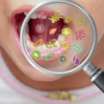 Bacterias en la boca Murcia