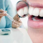 Como afecta la diabetes a la salud bucodental Murcia