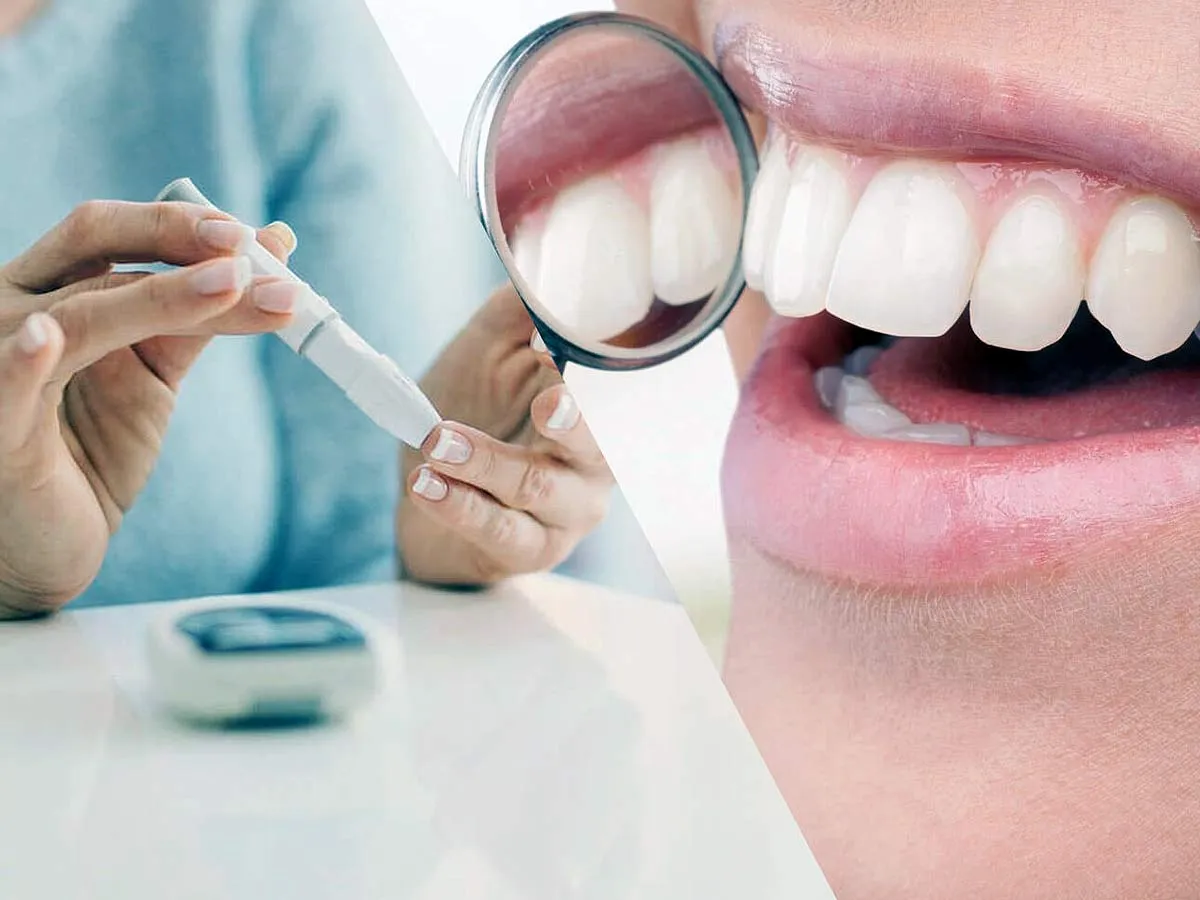 Como afecta la diabetes a la salud bucodental Murcia