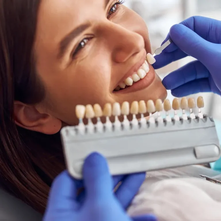 Evolución de las carillas de porcelana en Murcia