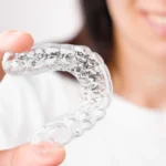 Férula de descarga para dolor de mandíbula en Murcia