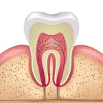 Nervio de un diente Murcia